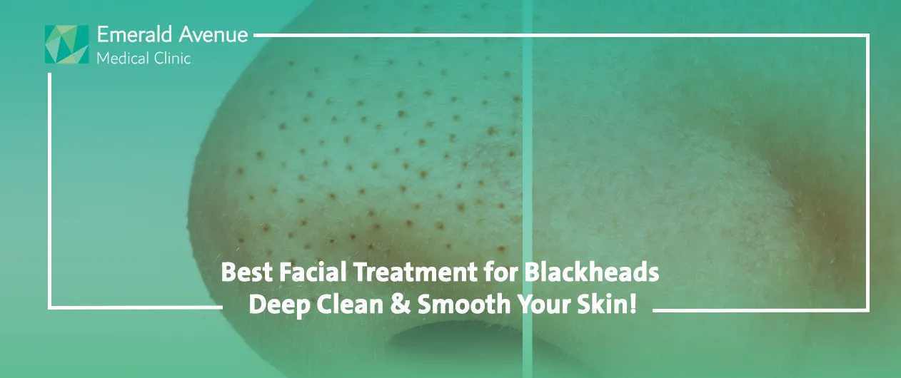 Best Facial Treatment for Blackheads
